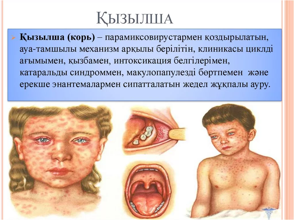 Қызылша